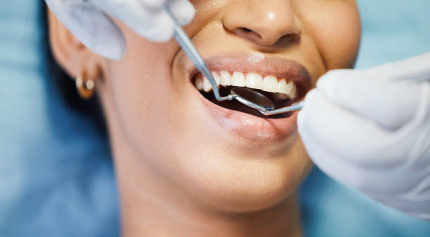 Best Emergency Dental Extractions in Palm Beach Gardens, FL