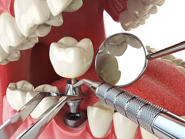 Best Mobile Emergency Dentist in Palm Beach Gardens, FL